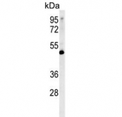 Western blot testing of human MCF7 cell lysate with Lymphocyte Specific Protein 1 antibody. Predicted molecular weight: ~37 kDa but is routinely observed at ~52 kDa (PMID: 15684321).