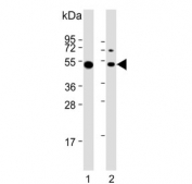 Western blot testing of human 1) Daudi and 2) Ramos cell lysate with Lymphocyte Specific Protein 1 antibody. Predicted molecular weight: ~37 kDa but is routinely observed at ~52 kDa (PMID: 15684321).