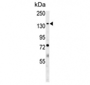 Western blot testing of mouse lung tissue lysate with Phospholipid-transporting ATPase IG antibody. Predicted molecular weight ~129 kDa.