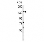 Western blot testing of mouse lung tissue lysate with Phospholipid-transporting ATPase IG antibody. Predicted molecular weight ~129 kDa.