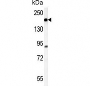 Western blot testing of hamster CHO lysate with Phospholipid-transporting ATPase IG antibody. Predicted molecular weight ~129 kDa.