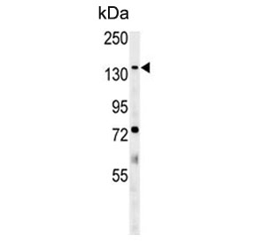 Western blot testing of mouse lung tissue lysate with Phospholipid-transporting ATPase IG antibody. Predicted molecular weight ~129 kDa.