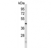 Western blot testing of human MDA-MB-231 cell lysate with PRB2 antibody. Predicted molecular weight ~41 kDa.