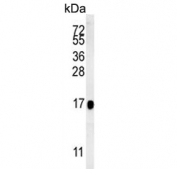 Western blot testing of human HepG2 cell lysate with BLOC1S2 antibody. Predicted molecular weight ~16 kDa.