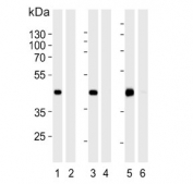 Western blot testing of human HEK293 cell lysate in the 1) absence and 2) presence of immunizing peptide, human HepG2 cell lysate in the 3) absence and 4) presence of immunizing peptide, and mouse spleen tissue lysate in the 5) absence and 6) presence of immunizing peptide with STEA2 antibody. Predicted molecular weight: 48-56 kDa (3 isoforms).