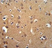 IHC testing of FFPE human brain tissue with ZDHHC2 antibody. HIER: steam section in pH6 citrate buffer for 20 min and allow to cool prior to staining.