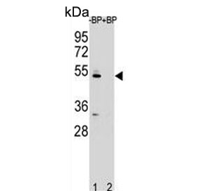 Western blot testing of human Ramos cell lysate in the absence and presence of immunizing/blocking peptide with ZDHHC2 antibody. Predicted molecular weight ~42 kDa.~