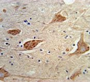 IHC testing of FFPE human brain tissue with FGFBP3 antibody. HIER: steam section in pH6 citrate buffer for 20 min and allow to cool prior to staining.