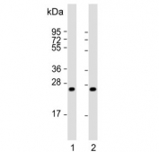 Western blot testing of 1) human liver and 2) mouse liver tissue lysate with HABP2 antibody. Predicted molecular weight ~63 kDa with processed forms at ~50 kDa, ~27 kDa and ~26 kDa.