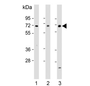 Western blot testing of human 1) A549, 2) MCF7 and 3) liver tissue lysate with HABP2 antibody. Predicted molecular weight ~63 kDa with processed forms at ~50 kDa, ~27 kDa and ~26 kDa.