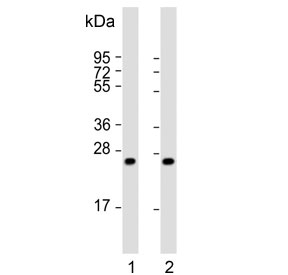 Western blot testing of 1) human liver and 2) mouse liver tissue lysate with HABP2 antibody. Predicted molecular weight ~63 kDa with processed forms at ~50 kDa, ~27 kDa and ~26 kDa.