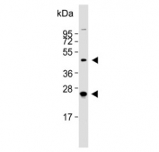 Western blot testing of human MCF7 cell lysate with HABP2 antibody. Predicted molecular weight ~63 kDa with processed forms at ~50 kDa, ~27 kDa and ~26 kDa.