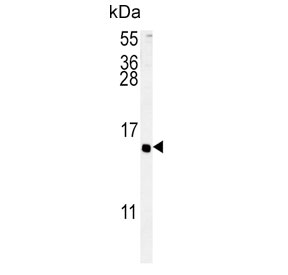 Western blot testing of human HEK293 cell lysate with ADCYAP1 antibody. Predicted molecular weight ~19 kDa but may be observed at up to 25 kDa.