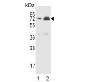 Western blot testing of human 1) CCRF-CEM and 2) K562 cell lysate with FHR-5 antibody. Predicted molecular weight ~64 kDa.