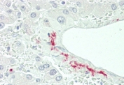 IHC testing of FFPE human liver tissue with FHR-5 antibody. HIER: steam section in pH6 citrate buffer for 20 min and allow to cool prior to staining.