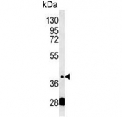 Western blot testing of mouse liver tissue lysate with Paraoxonase 2 antibody. Predicted molecular weight ~39 kDa.