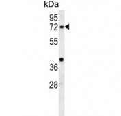 Western blot testing of mouse kidney tissue lysate with Kelch-like protein 6 antibody. Predicted molecular weight ~71 kDa.