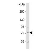 Western blot testing of human Raji cell lysate with Kelch-like protein 6 antibody. Predicted molecular weight ~71 kDa.