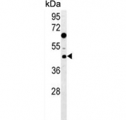 Western blot testing of human MCF7 cell lysate with DNAJA1 antibody. Predicted molecular weight ~45 kDa.
