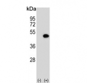 Western blot testing of 1) non-transfected and 2) transfected 293 cell lysate with ILKAP antibody.