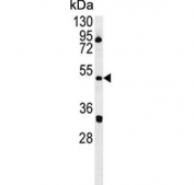 Western blot testing of human HEK293 cell lysate with ILKAP antibody. Predicted molecular weight ~43 kDa.