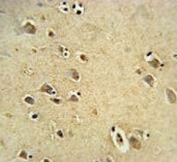 IHC testing of FFPE human brain tissue with DIRAS3 antibody. HIER: steam section in pH6 citrate buffer for 20 min and allow to cool prior to staining.