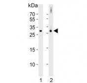 Western blot testing of human 1) HeLa and 2) ovary tissue lysate with DIRAS3 antibody. Predicted molecular weight ~26 kDa.