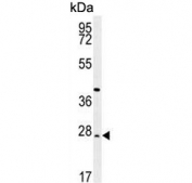 Western blot testing of human WiDr cell lysate with DIRAS3 antibody. Predicted molecular weight ~26 kDa.