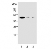 Western blot testing of human 1) HL60, 2) Jurkat and 3) HEK293 cell lysate with S1PR4 antibody. Predicted molecular weight ~42 kDa.