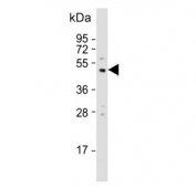 Western blot testing of human MBA-MD-231 cell lysate with Collagenase 3 antibody. Predicted molecular weight ~54 kDa.