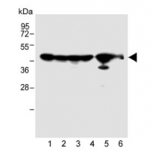 Western blot testing of 1) human A2058, 2) human HT-1080, 3) human MCF-7, 4) human NCI-H292, 5) mouse kidney and 6) rat kidney tissue lysate with MMP14 antibody. Predicted molecular weight ~66 kDa (pro form), ~54 kDa (active form), ~44 kDa (inactive form).