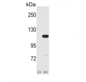 Western blot testing of 1) non-transfected and 2) transfected 293 cell lysate with Major Vault Protein antibody.