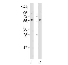 Western blot testing of human 1) HeLa and 2) HL60 cell lysate with Presenilin 1 antibody. Predicted molecular weight ~53 kDa.