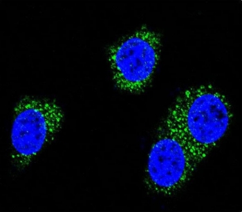 Immunofluorescent staining of human MDA-MB-435 cells with Presenilin 1 antibody (green) and DAPI nuclear stain (blue).