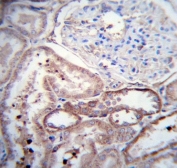IHC testing of FFPE human kidney tissue with Pdgfd antibody. HIER: steam section in pH6 citrate buffer for 20 min and allow to cool prior to staining.