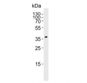 Western blot testing of rat kidney tissue lysate with Pdgfd antibody. Predicted molecular weight ~43 kDa.