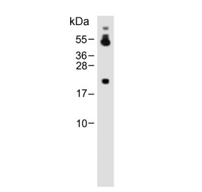 Western blot testing of human HeLa cell lysate with REDD-1 antibody. Predicted molecular weight ~25 kDa.