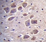 IHC testing of FFPE human brain tissue with Calcipressin-2 antibody. HIER: steam section in pH6 citrate buffer for 20 min and allow to cool prior to staining.