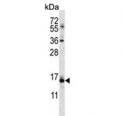 Western blot testing of NCI-H460 cell lysate with Calcipressin-2 antibody. Predicted molecular weight ~22 kDa.