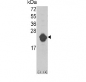 Western blot testing of 1) non-transfected and 2) transfected 293 cell lysate with IL1RN antibody.
