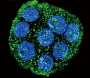 Immunofluorescent staining of human WiDr cells with IL1RN antibody (green) and DAPI nuclear stain (blue).