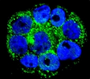 Immunofluorescent staining of human WiDr cells with Interleukin-1 Receptor Antagonist antibody (green) and DAPI nuclear stain (blue).