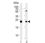 Western blot testing of human 1) HEK293 and 2) HeLa cell lysate with Interleukin-1 Receptor Antagonist antibody. Predicted molecular weight ~20 kDa.