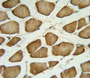 IHC testing of FFPE human skeletal muscle tissue with Caveolin-3 antibody. HIER: steam section in pH6 citrate buffer for 20 min and allow to cool prior to staining.