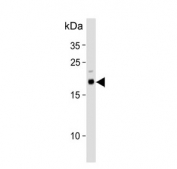Western blot testing of human uterus tissue lysate with Caveolin-3 antibody. Predicted molecular weight: ~17 kDa but routinely observed at 20~25 kDa.