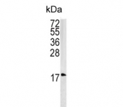Western blot testing of human HEK293 cell lysate with Caveolin-3 antibody. Predicted molecular weight: ~17 kDa but routinely observed at 20~25 kDa.