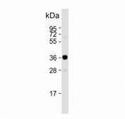 Western blot testing of human HeLa cell lysate with ARPC1A antibody. Predicted molecular weight ~42 kDa.