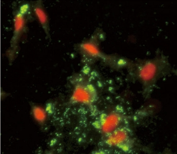 Immunofluorescent staining of human HeLa cells with ARPC1A antibody (green) and PI (red).