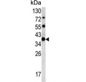 Western blot testing of human HL60 cell lysate with CLNS1A antibody. Predicted molecular weight ~26 kDa.