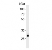 Western blot testing of human U-251 cell lysate with CNOT8 antibody. Predicted molecular weight ~33 kDa.